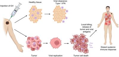 Biosafety and biohazard considerations of HSV-1–based oncolytic viral immunotherapy